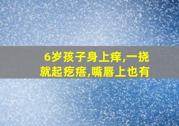 6岁孩子身上痒,一挠就起疙瘩,嘴唇上也有