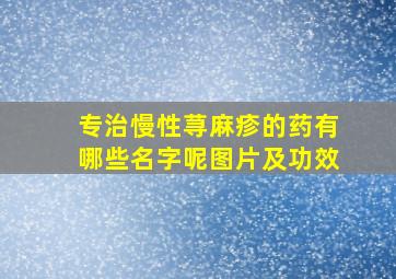 专治慢性荨麻疹的药有哪些名字呢图片及功效