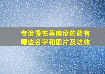 专治慢性荨麻疹的药有哪些名字和图片及功效