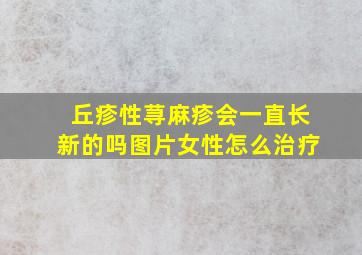 丘疹性荨麻疹会一直长新的吗图片女性怎么治疗