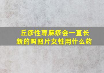 丘疹性荨麻疹会一直长新的吗图片女性用什么药