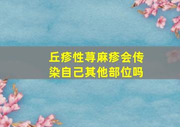 丘疹性荨麻疹会传染自己其他部位吗