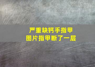 严重缺钙手指甲图片指甲断了一层