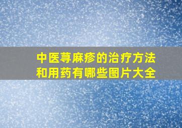 中医荨麻疹的治疗方法和用药有哪些图片大全