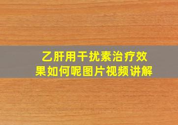 乙肝用干扰素治疗效果如何呢图片视频讲解