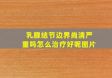 乳腺结节边界尚清严重吗怎么治疗好呢图片