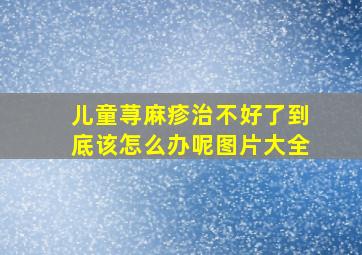 儿童荨麻疹治不好了到底该怎么办呢图片大全