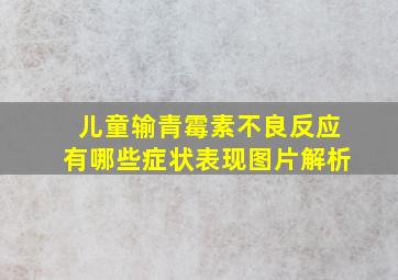 儿童输青霉素不良反应有哪些症状表现图片解析