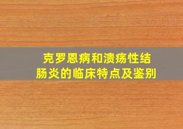 克罗恩病和溃疡性结肠炎的临床特点及鉴别