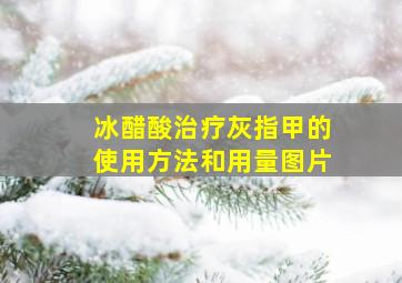 冰醋酸治疗灰指甲的使用方法和用量图片