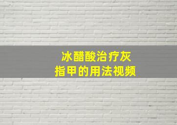 冰醋酸治疗灰指甲的用法视频