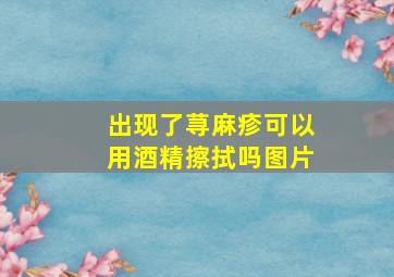 出现了荨麻疹可以用酒精擦拭吗图片