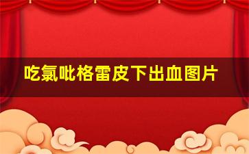 吃氯吡格雷皮下出血图片