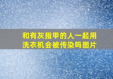 和有灰指甲的人一起用洗衣机会被传染吗图片