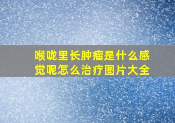 喉咙里长肿瘤是什么感觉呢怎么治疗图片大全