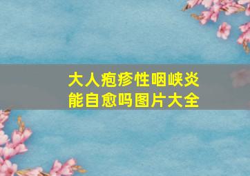 大人疱疹性咽峡炎能自愈吗图片大全