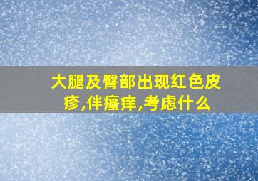 大腿及臀部出现红色皮疹,伴瘙痒,考虑什么