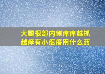 大腿根部内侧痒痒越抓越痒有小疙瘩用什么药