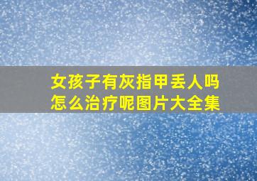 女孩子有灰指甲丢人吗怎么治疗呢图片大全集