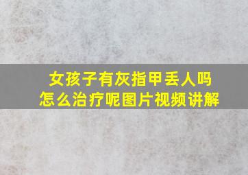 女孩子有灰指甲丢人吗怎么治疗呢图片视频讲解