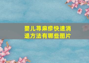 婴儿荨麻疹快速消退方法有哪些图片