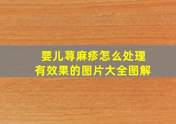 婴儿荨麻疹怎么处理有效果的图片大全图解