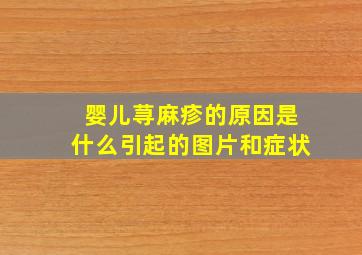 婴儿荨麻疹的原因是什么引起的图片和症状