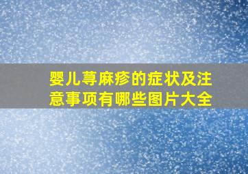 婴儿荨麻疹的症状及注意事项有哪些图片大全