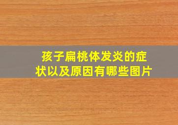 孩子扁桃体发炎的症状以及原因有哪些图片