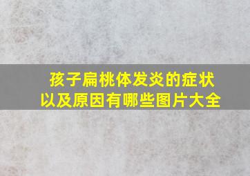 孩子扁桃体发炎的症状以及原因有哪些图片大全