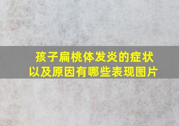 孩子扁桃体发炎的症状以及原因有哪些表现图片