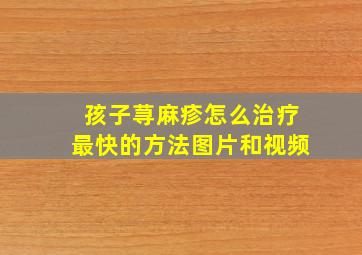 孩子荨麻疹怎么治疗最快的方法图片和视频