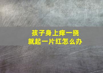 孩子身上痒一挠就起一片红怎么办