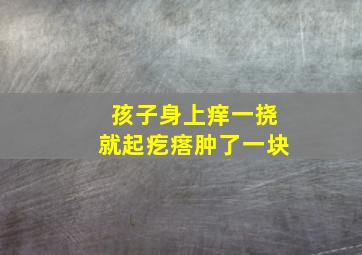 孩子身上痒一挠就起疙瘩肿了一块