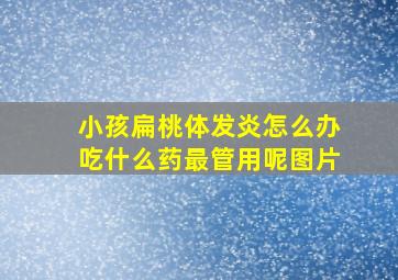 小孩扁桃体发炎怎么办吃什么药最管用呢图片