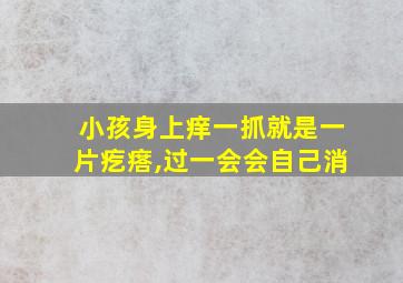 小孩身上痒一抓就是一片疙瘩,过一会会自己消