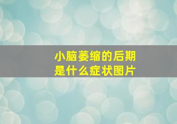 小脑萎缩的后期是什么症状图片