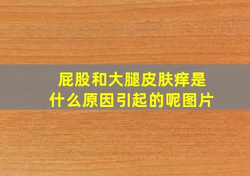 屁股和大腿皮肤痒是什么原因引起的呢图片