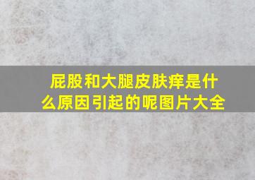 屁股和大腿皮肤痒是什么原因引起的呢图片大全