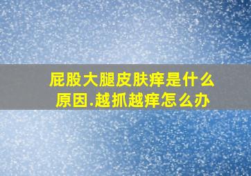 屁股大腿皮肤痒是什么原因.越抓越痒怎么办