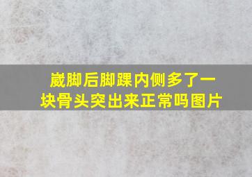 崴脚后脚踝内侧多了一块骨头突出来正常吗图片