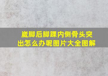 崴脚后脚踝内侧骨头突出怎么办呢图片大全图解