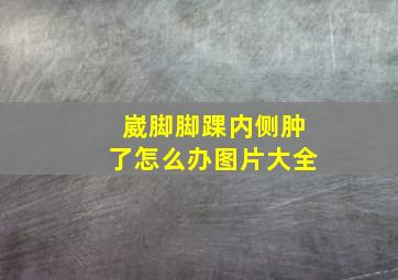 崴脚脚踝内侧肿了怎么办图片大全