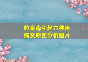 帕金森引起六种疼痛及原因分析图片