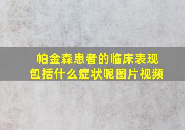 帕金森患者的临床表现包括什么症状呢图片视频