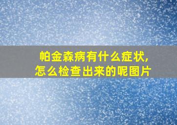 帕金森病有什么症状,怎么检查出来的呢图片