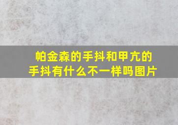 帕金森的手抖和甲亢的手抖有什么不一样吗图片