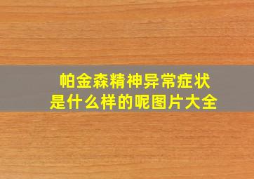 帕金森精神异常症状是什么样的呢图片大全