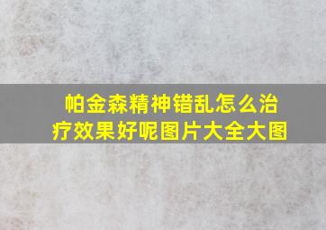 帕金森精神错乱怎么治疗效果好呢图片大全大图