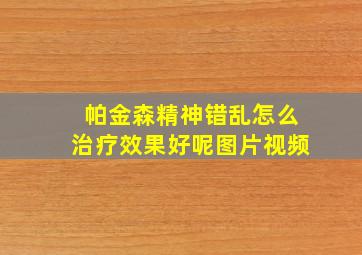 帕金森精神错乱怎么治疗效果好呢图片视频